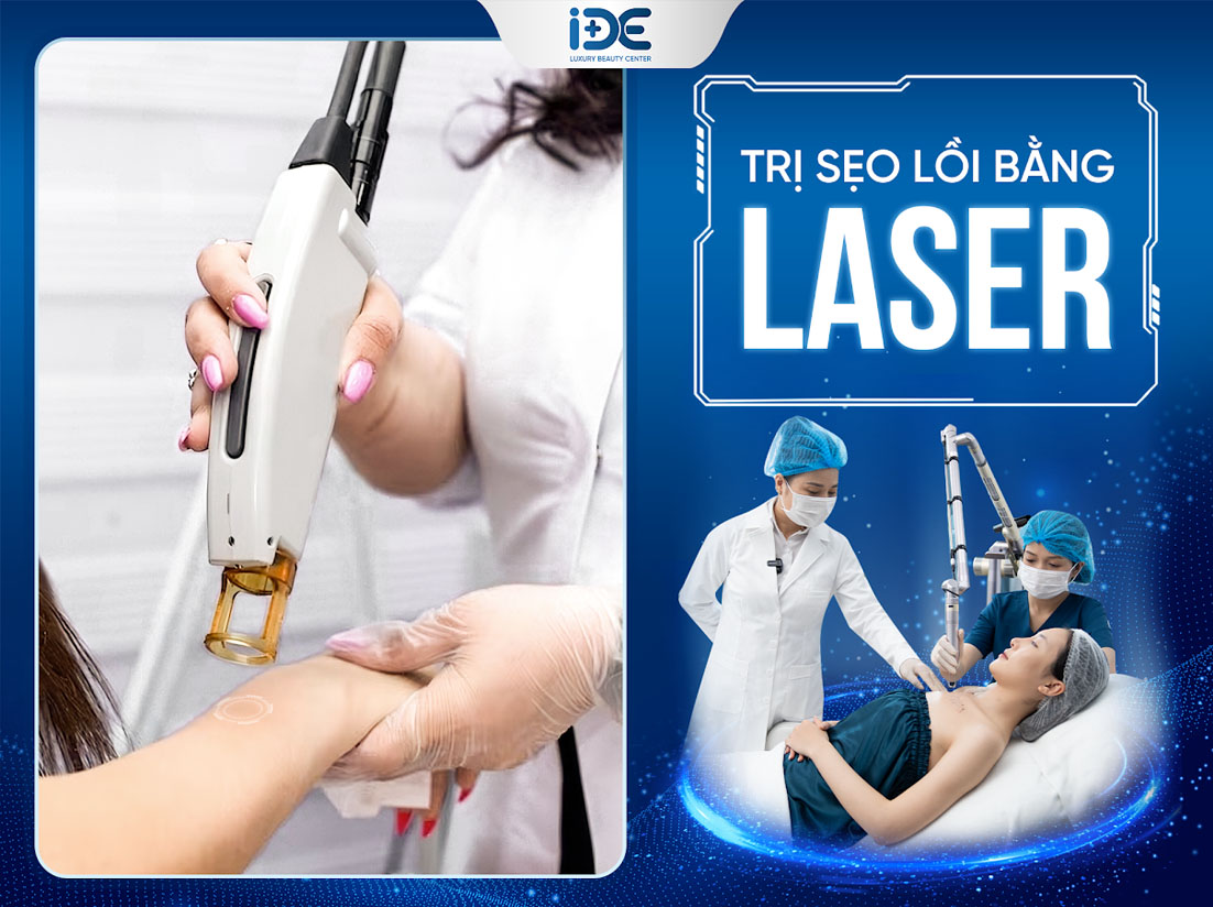 Dùng laser để chữa trị sẹo lồi