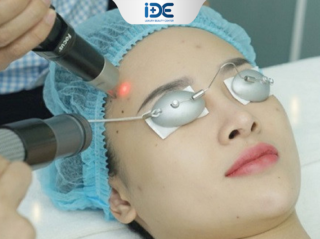 (Xóa sẹo thâm với phương pháp Laser)